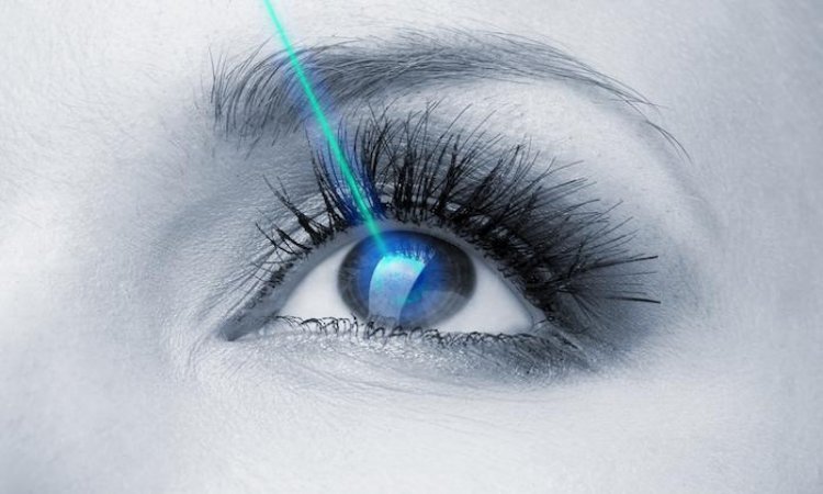 How to Prepare for LASIK Surgery: Step-by-Step Guide